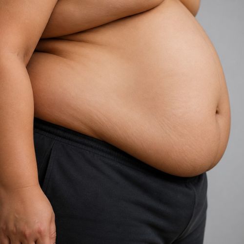 Obesity and Belly Fat
